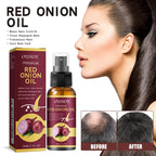 Spray para el cuidado del aceite esencial para el crecimiento del cabello, cebolla roja, previene la caída del cabello, nutre las raíces, mejora la textura del cabello, productos para el cuidado