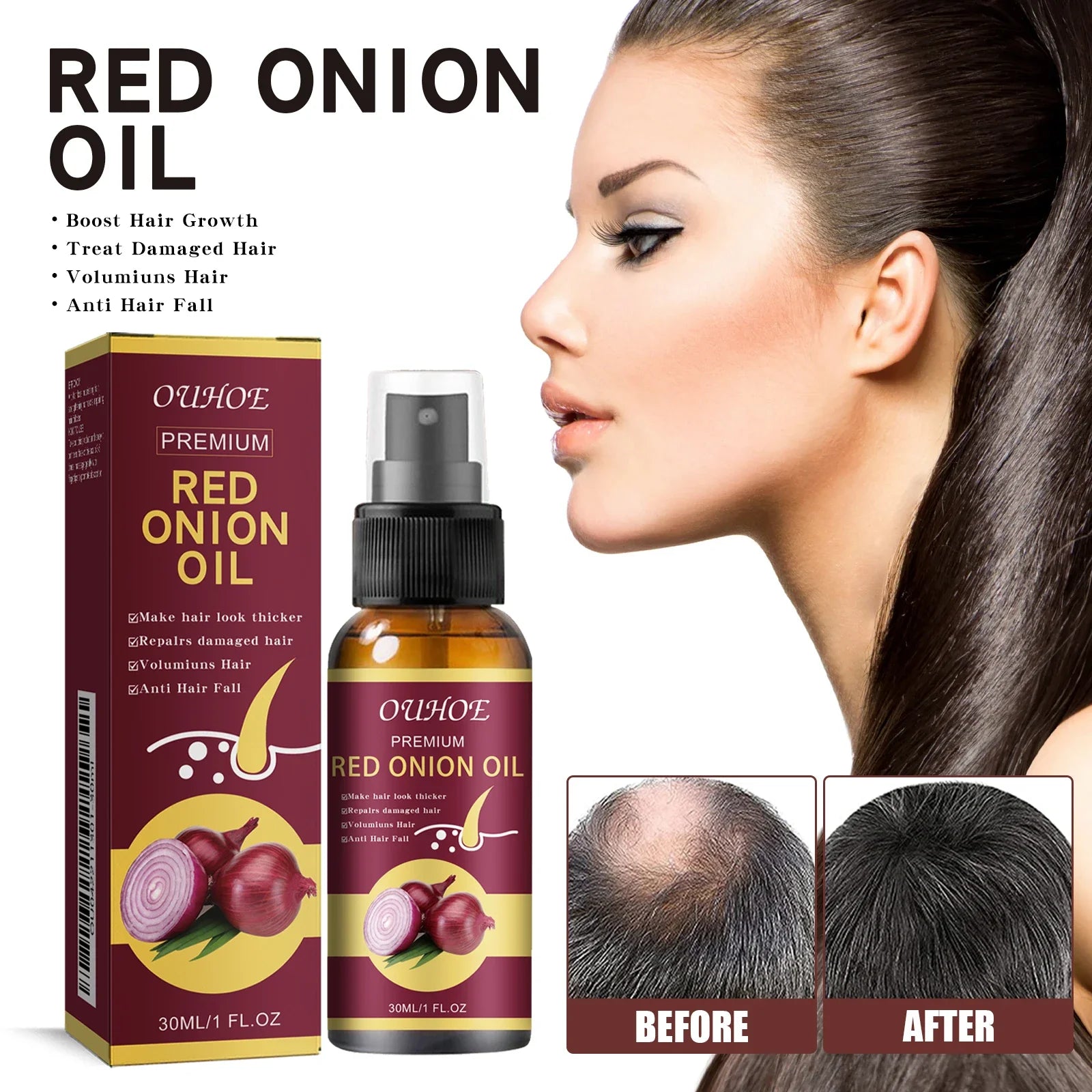 Spray para el cuidado del aceite esencial para el crecimiento del cabello, cebolla roja, previene la caída del cabello, nutre las raíces, mejora la textura del cabello, productos para el cuidado