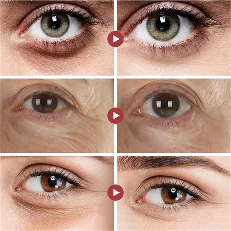 Crema Instantánea Para Bolsas De Ojos | Retinol Antiarrugas Colágeno | Reafirmante Unisex