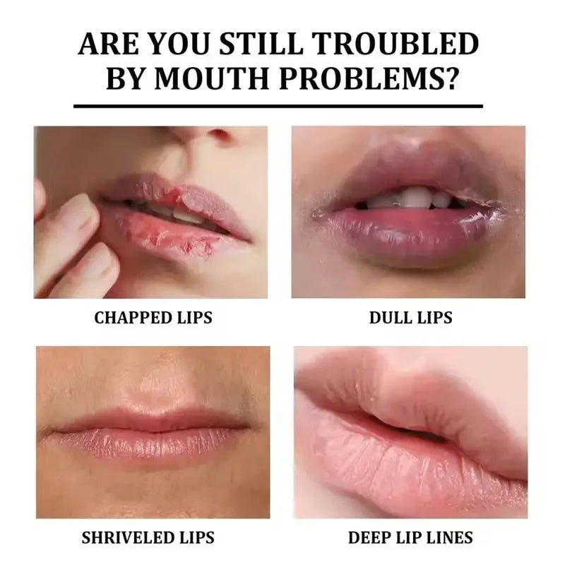 Bálsamo Labial Oscuro Elimina Melanina | Aclara Exfolia Hidrata | Cuidado Labios Completo