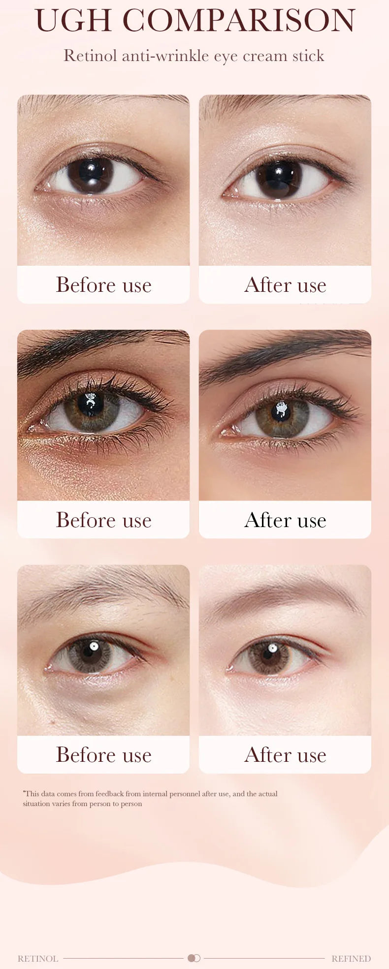 Crema Instantánea Para Bolsas De Ojos | Retinol Antiarrugas Colágeno | Reafirmante Unisex