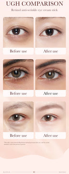 Crema Instantánea Para Bolsas De Ojos | Retinol Antiarrugas Colágeno | Reafirmante Unisex
