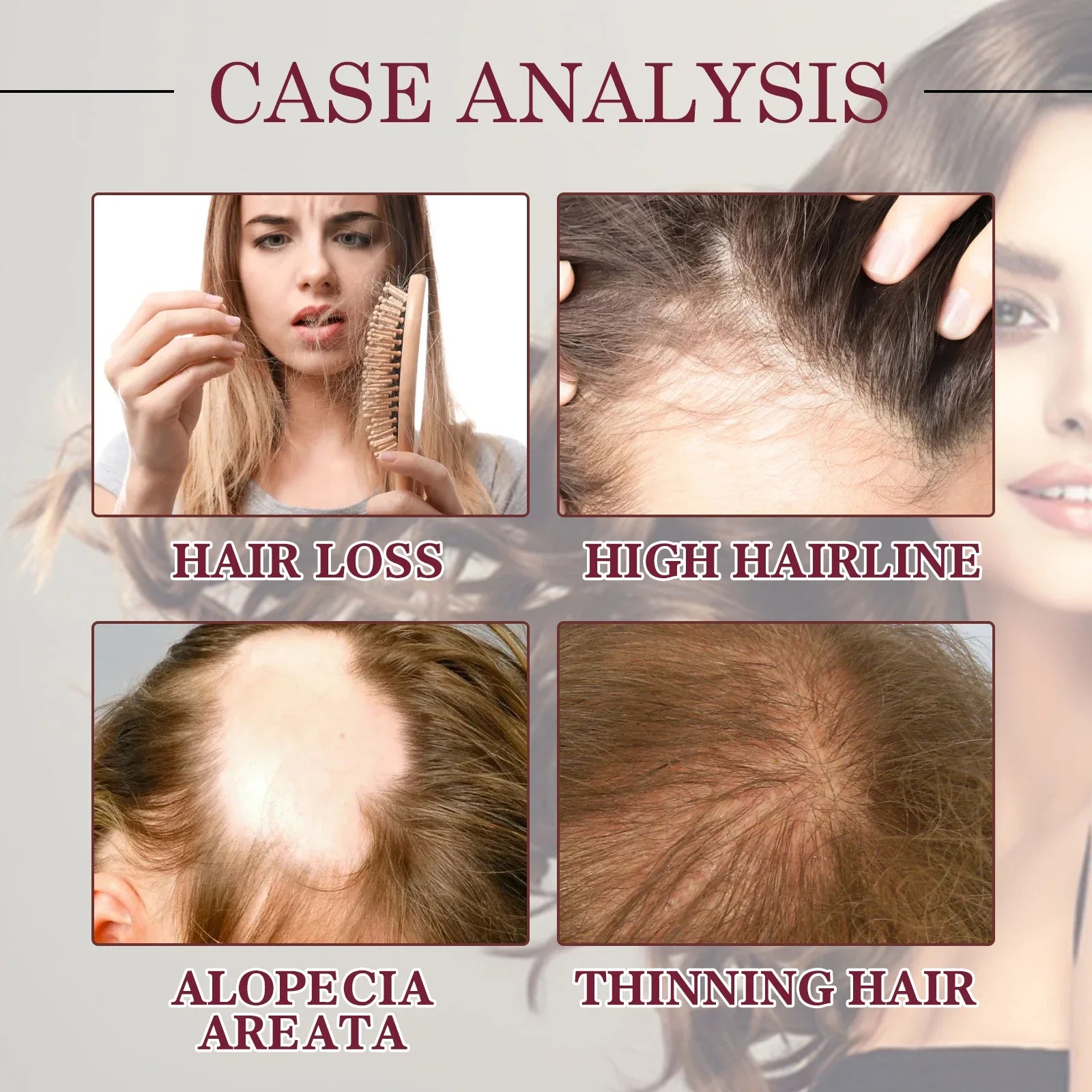 Spray para el cuidado del aceite esencial para el crecimiento del cabello, cebolla roja, previene la caída del cabello, nutre las raíces, mejora la textura del cabello, productos para el cuidado