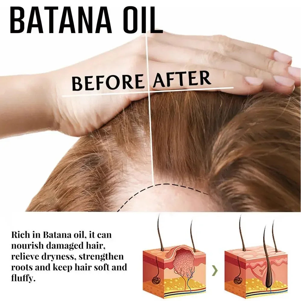 Batana Oil Spray repara la calvicie fortalece el cabello nutrición Natural tratamiento de pérdida hereditaria, hidrata el cuero cabelludo todos los género