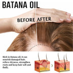 Batana Oil Spray repara la calvicie fortalece el cabello nutrición Natural tratamiento de pérdida hereditaria, hidrata el cuero cabelludo todos los género