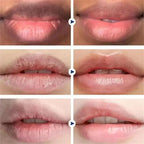 Bálsamo Labial Oscuro Elimina Melanina | Aclara Exfolia Hidrata | Cuidado Labios Completo