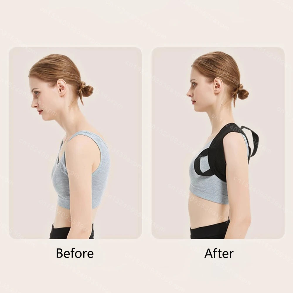Corrector de postura de espalda, cinturón ajustable para clavícula, columna vertebral, Unisex, parte superior de la espalda, hombros, corrección de postura Lumbar, moldeador de cuerpo