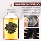 Nuevo asesino de cabello blanco, líquido de esencia polygonum multiflorum que elimina el cabello gris y restaura el color natural del cabello en 7 días 2025