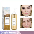 Aceite Limpiador Desmaquillante Facial | Centella Vitamina E | Control Sebo Piel Sensible