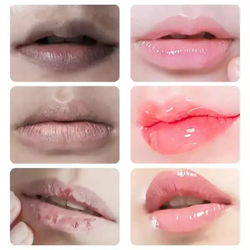 Bálsamo Labial Oscuro Elimina Melanina | Aclara Exfolia Hidrata | Cuidado Labios Completo