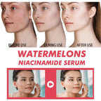 60ml sandía brillo niacinamida gotas de rocío suero imprimación resaltador suero ligero hidratante suero de Maquillaje facial 2025