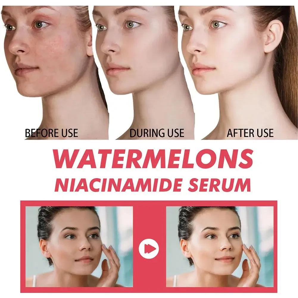 60ml sandía brillo niacinamida gotas de rocío suero imprimación resaltador suero ligero hidratante suero de Maquillaje facial 2025