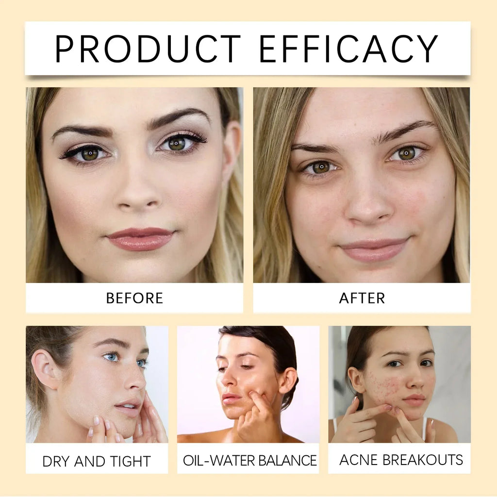 Aceite Limpiador Desmaquillante Facial | Centella Vitamina E | Control Sebo Piel Sensible
