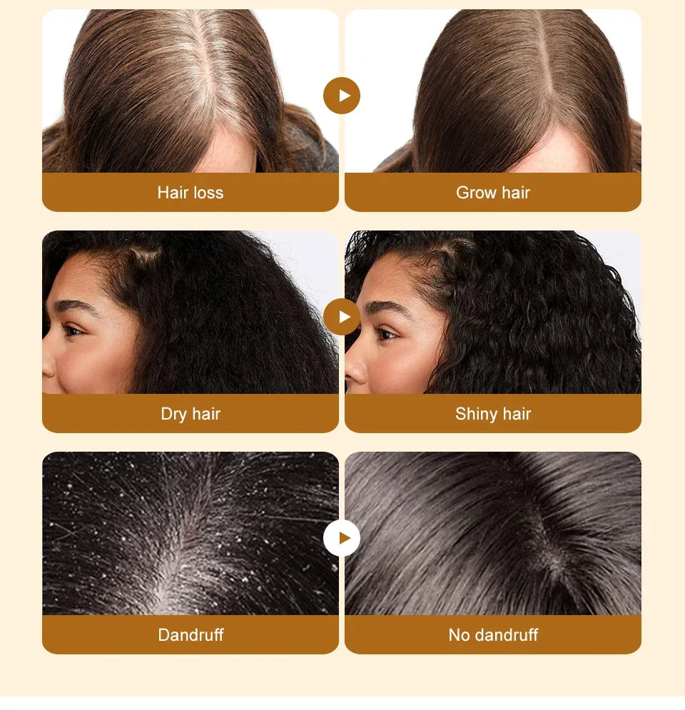 Aceite de Batana natural para hombres y mujeres, crecimiento rápido del cabello, aceite de Batana puro, nutre el cabello brillante, cuidado saludable, antipérdida de cabello