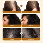 Aceite de Batana natural para hombres y mujeres, crecimiento rápido del cabello, aceite de Batana puro, nutre el cabello brillante, cuidado saludable, antipérdida de cabello