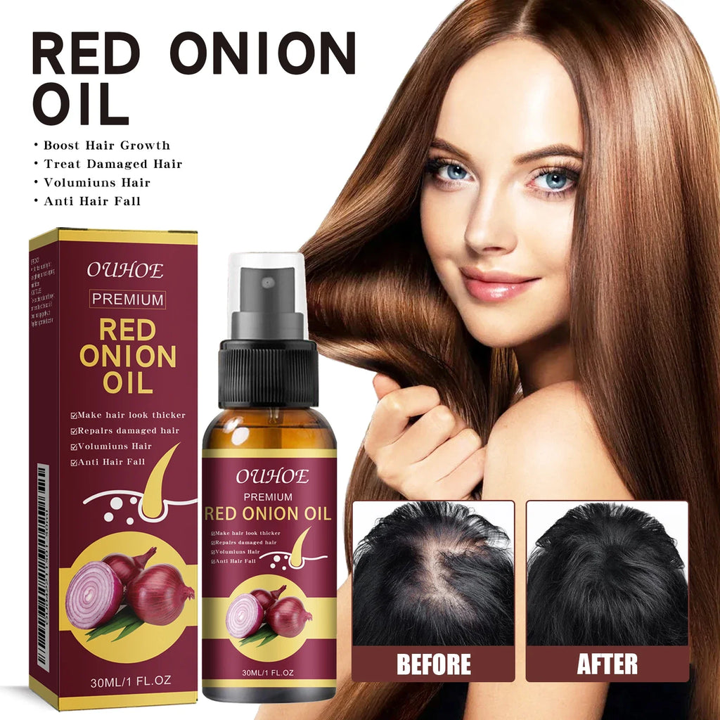 Spray para el cuidado del aceite esencial para el crecimiento del cabello, cebolla roja, previene la caída del cabello, nutre las raíces, mejora la textura del cabello, productos para el cuidado