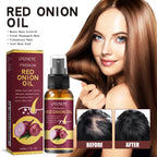Spray para el cuidado del aceite esencial para el crecimiento del cabello, cebolla roja, previene la caída del cabello, nutre las raíces, mejora la textura del cabello, productos para el cuidado
