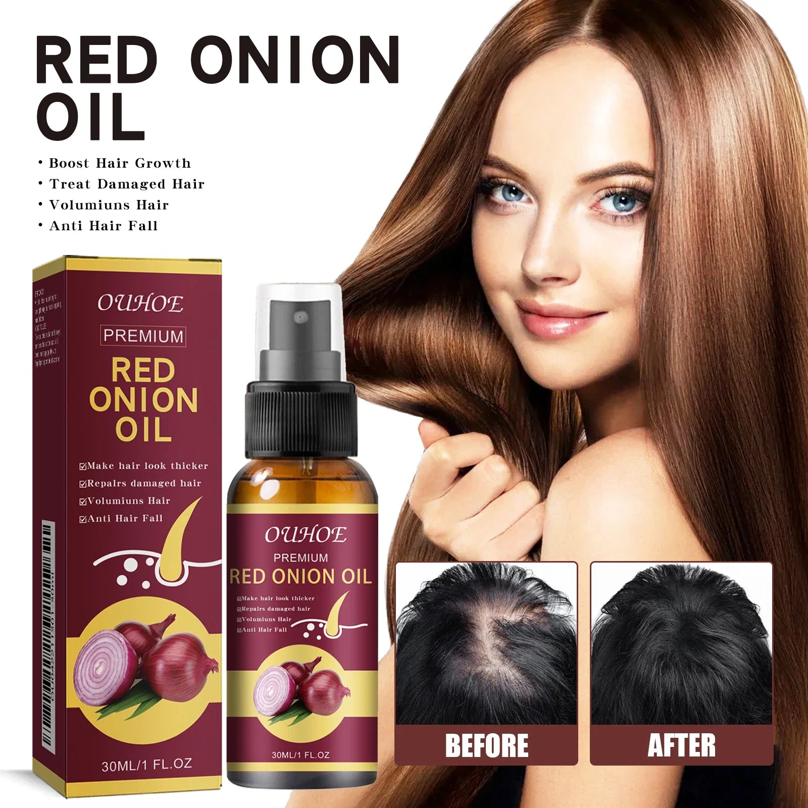 Spray para el cuidado del aceite esencial para el crecimiento del cabello, cebolla roja, previene la caída del cabello, nutre las raíces, mejora la textura del cabello, productos para el cuidado