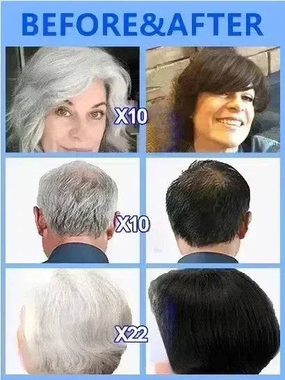 Nuevo asesino de cabello blanco, líquido de esencia polygonum multiflorum que elimina el cabello gris y restaura el color natural del cabello en 7 días 2025