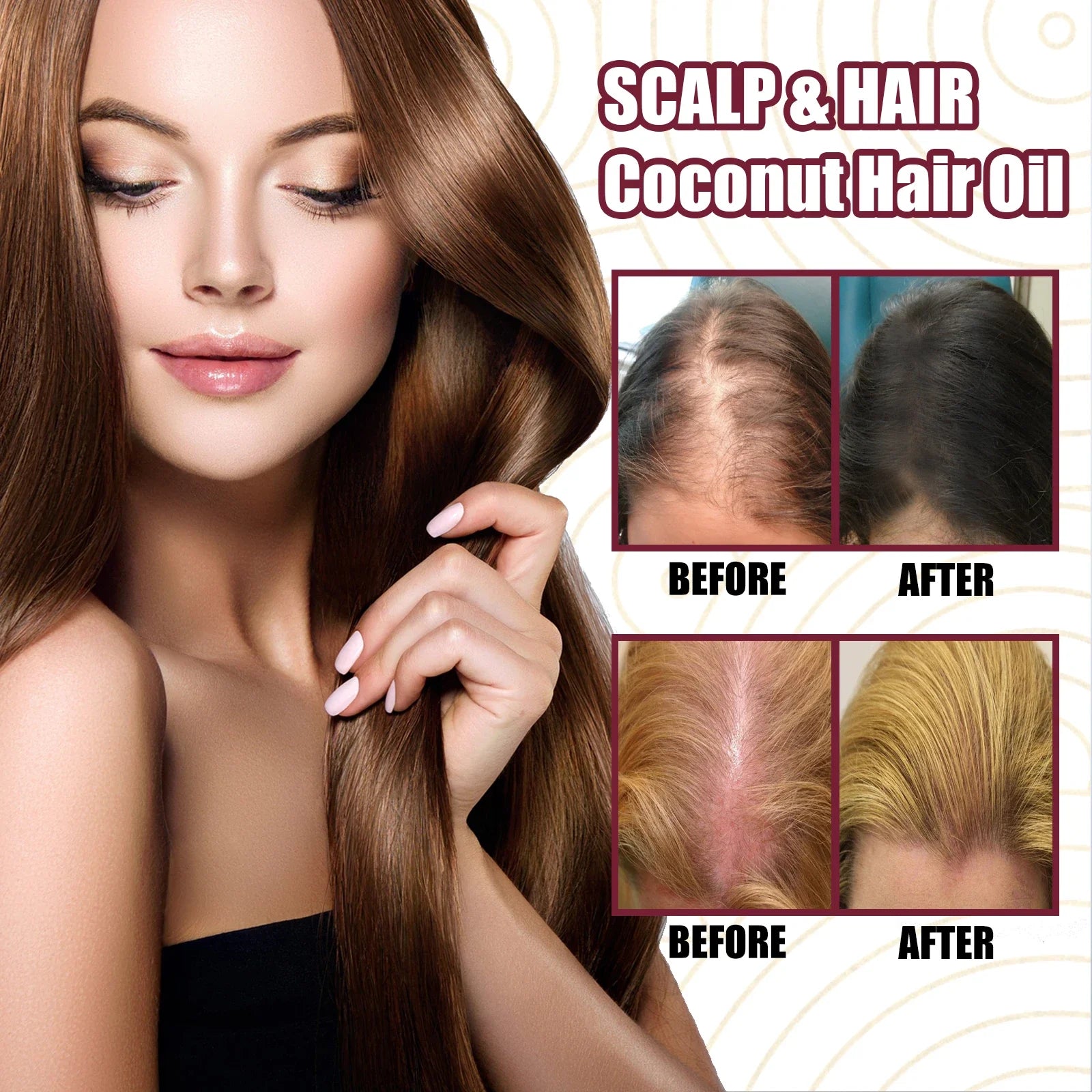 Spray para el cuidado del aceite esencial para el crecimiento del cabello, cebolla roja, previene la caída del cabello, nutre las raíces, mejora la textura del cabello, productos para el cuidado