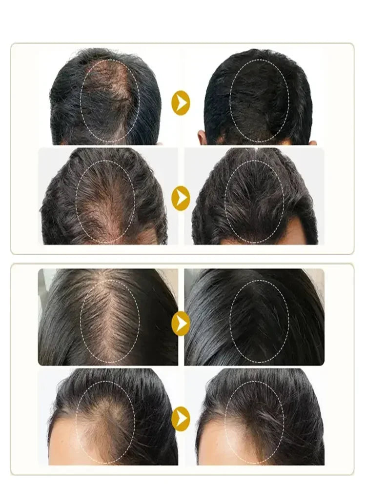 Aceite de Ricino Negro | Hidrata y Define Rizos | Repara Cabello Seco y Enredos