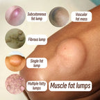 Crema Calmante Corporal | Eliminador Subcutáneo De Celulitis | Tratamiento Grasa Indoloro