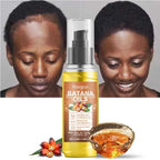 Aceite de Batana natural para hombres y mujeres, crecimiento rápido del cabello, aceite de Batana puro, nutre el cabello brillante, cuidado saludable, antipérdida de cabello