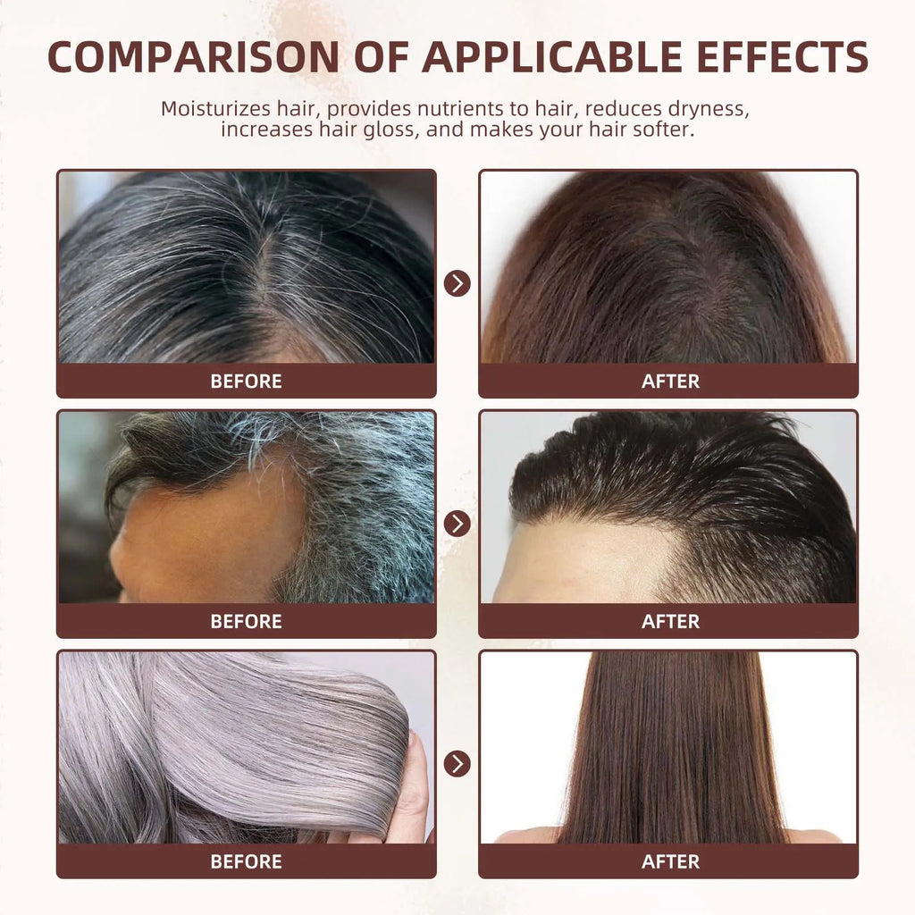 Nuevo asesino de cabello blanco, líquido de esencia polygonum multiflorum que elimina el cabello gris y restaura el color natural del cabello en 7 días 2025