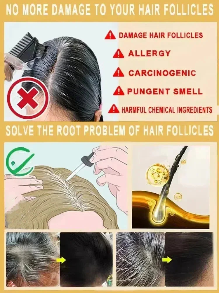 Nuevo asesino de cabello blanco, líquido de esencia polygonum multiflorum que elimina el cabello gris y restaura el color natural del cabello en 7 días 2025