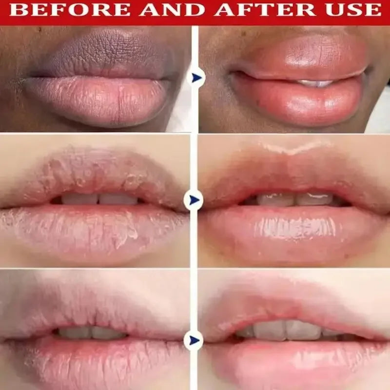 Bálsamo Labial Oscuro Elimina Melanina | Aclara Exfolia Hidrata | Cuidado Labios Completo