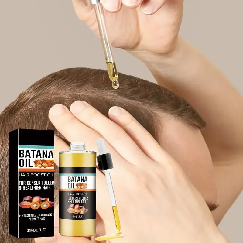 Batana Oil Spray repara la calvicie fortalece el cabello nutrición Natural tratamiento de pérdida hereditaria, hidrata el cuero cabelludo todos los género