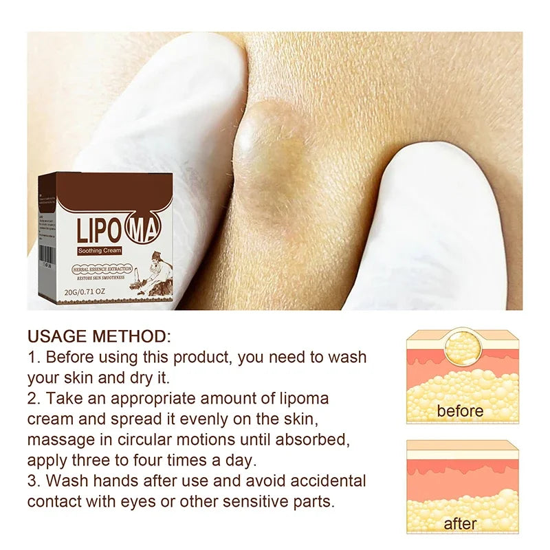 Crema Calmante Corporal | Eliminador Subcutáneo De Celulitis | Tratamiento Grasa Indoloro