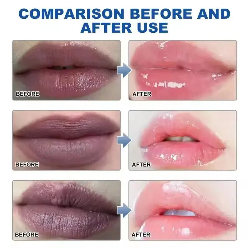 Bálsamo Labial Oscuro Elimina Melanina | Aclara Exfolia Hidrata | Cuidado Labios Completo