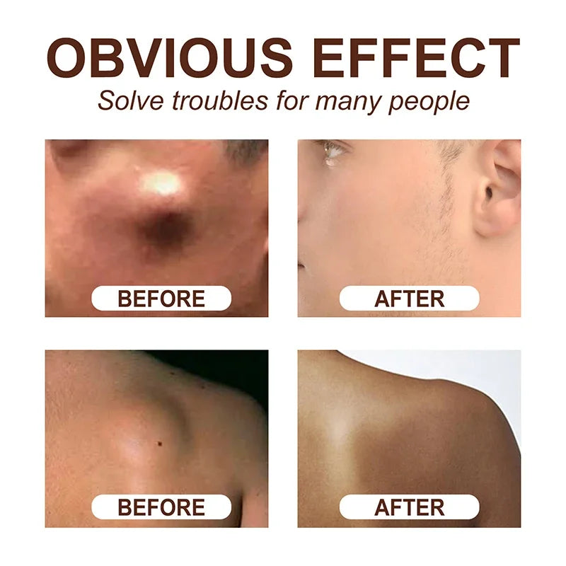 Crema Calmante Corporal | Eliminador Subcutáneo De Celulitis | Tratamiento Grasa Indoloro