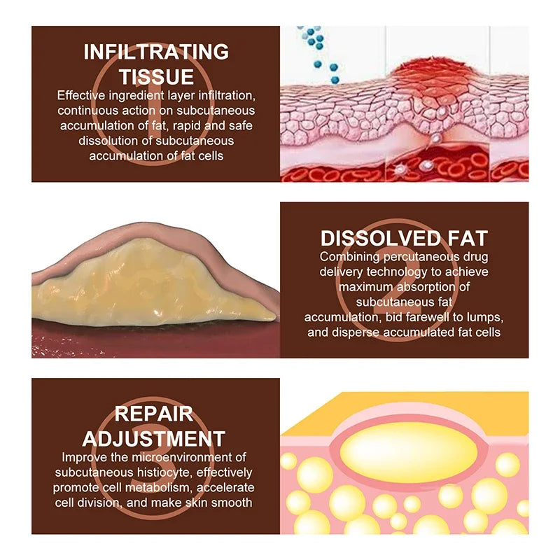 Crema Calmante Corporal | Eliminador Subcutáneo De Celulitis | Tratamiento Grasa Indoloro
